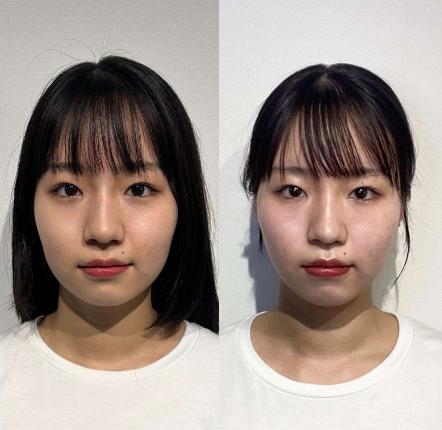 髪は下ろすより結ぶほうが小顔に見える? | ブログ | 東京都代官山の整体なら骨美整salon