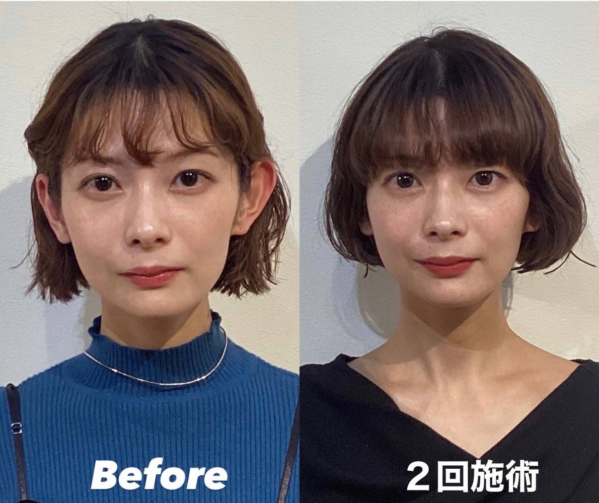 顎関節締めると顔筋緩和で求心顔へ | コラム | 東京都代官山の整体なら骨美整salon