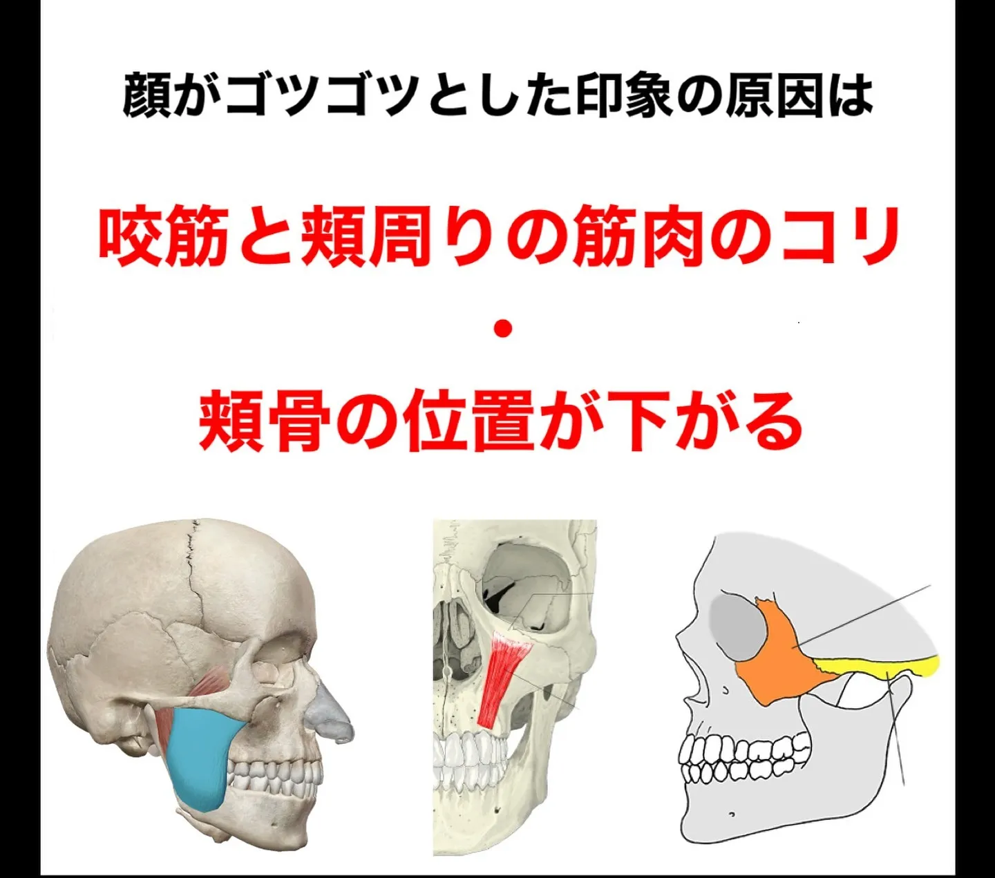 顔の印象を大きく左右するパーツの頬骨は、美しさを演出する上で...