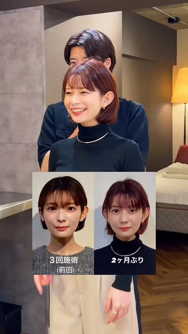 顎ズレや咬筋の左右差は、小顔矯正において重要なポイントの一つ...