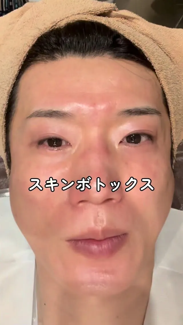 これからの季節に一押しの【スキンボトックス】です！